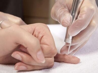 Réaliser une thérapie au laser